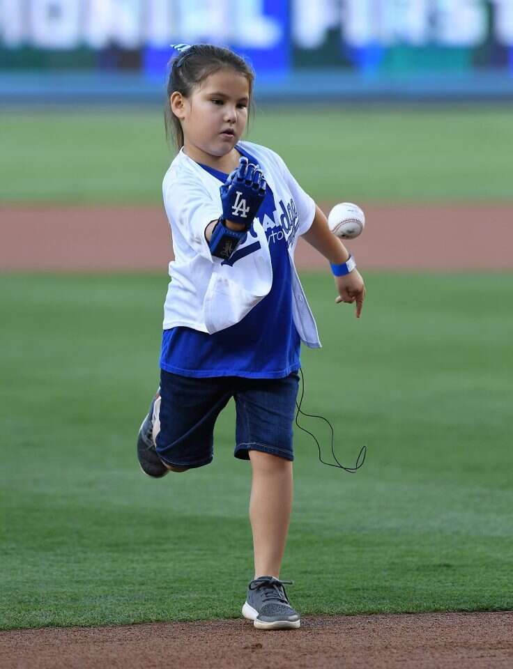 היילי דוסון, הלוקה בתסמונת פולנד המעוותת את כף היד, משתמשת ביד ביונית שהודפסה בתלת־ממד כדי לשחק בייסבול. | AFP