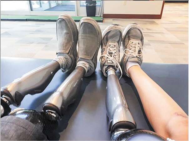 "אמרתי לרופאים שאני מעדיפה למות עם שתי רגליים מאשר לחיות עם רגל אחת". | אלבום פרטי