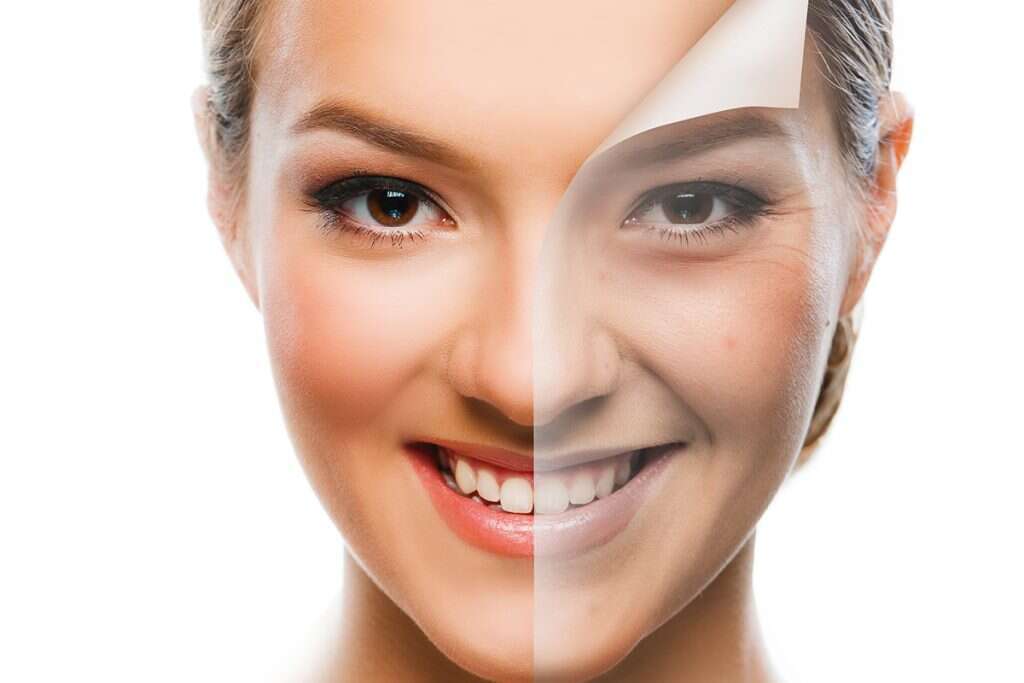 טיפולי פיגמנטציה אצל ד”R לריסה ברק