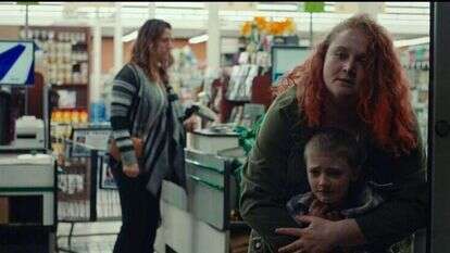 "סקין". | אבדיבות yes