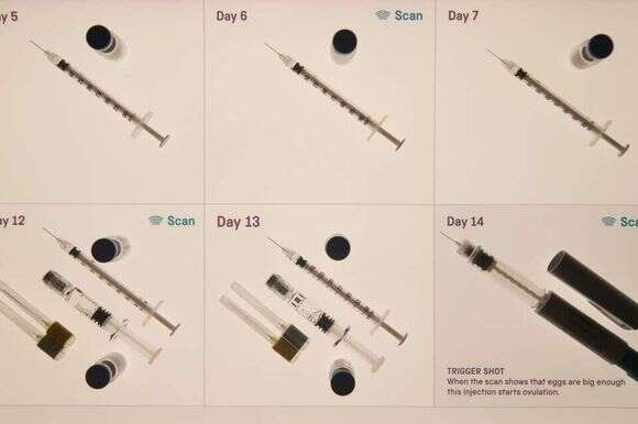 ישראל היא במקום הראשון בעולם בהפריה חוץ־גופית. ציוד IVF. | AFP ישראל היא במקום הראשון בעולם בהפריה חוץ־גופית. ציוד IVF. | AFP
