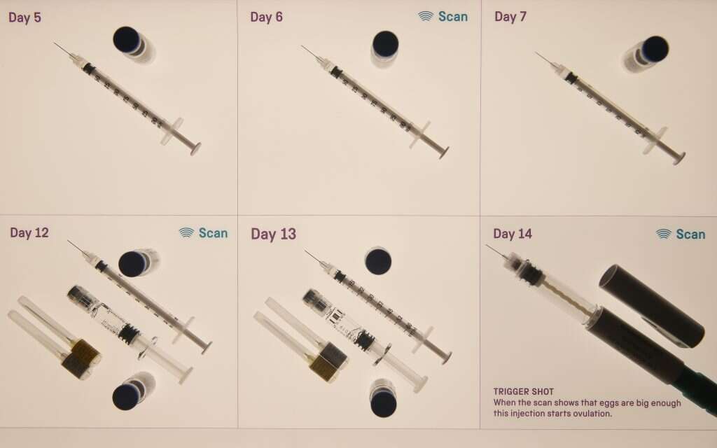 ישראל היא במקום הראשון בעולם בהפריה חוץ־גופית. ציוד IVF. | AFP