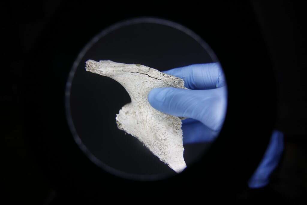 בדיקת עצם במכון לרפואה משפטית באבו־כביר ,CORINNA KERN. | וושינגטון פוסט