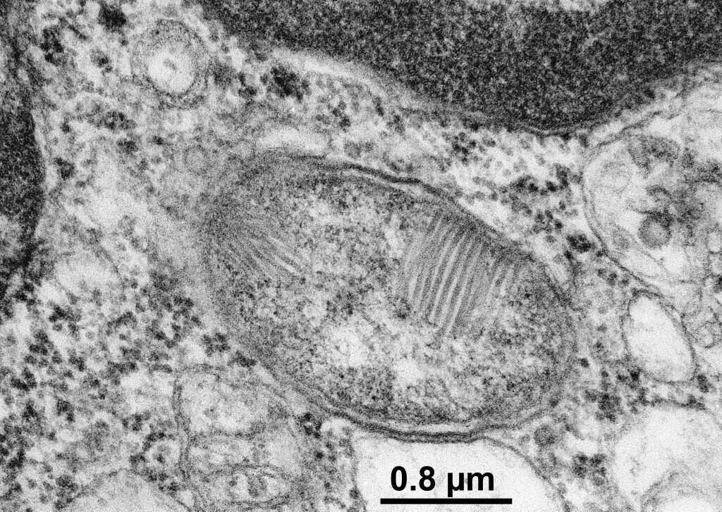הפספסים העניקו לחיידק את שמו הייחודי. החיידק קרדיניום. | צחורי-פיין ובורציס
