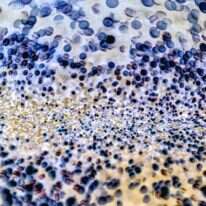 חיידקים תחת המיקרוסקופ. | שאטרסטוק