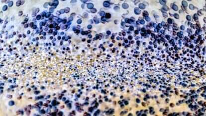 חיידקים תחת המיקרוסקופ. | שאטרסטוק