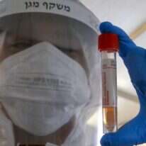 דגימה במתחם הבדק וסע של מד"א. | AFP