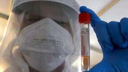 דגימה במתחם הבדק וסע של מד"א. | AFP