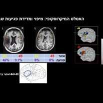 פרופ' גרודז'ינסקי. | מסך