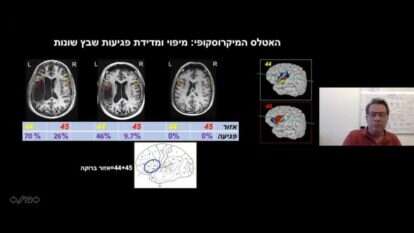 פרופ' גרודז'ינסקי. | מסך