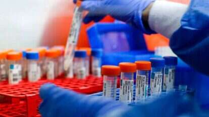 בדיקות קורונה. | AFP