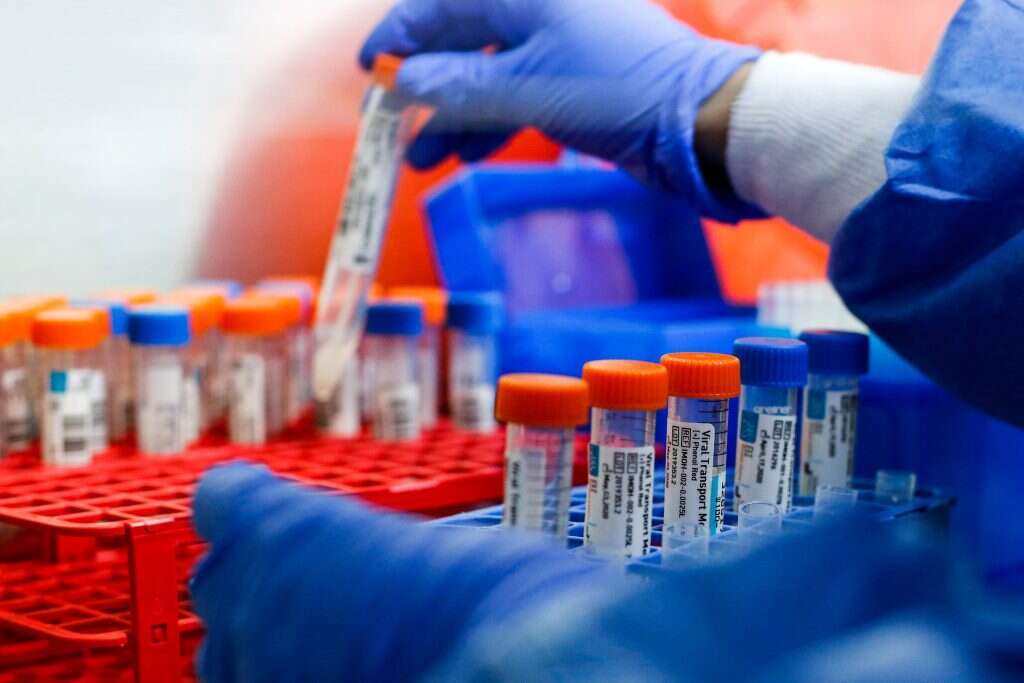 בדיקות קורונה. | AFP