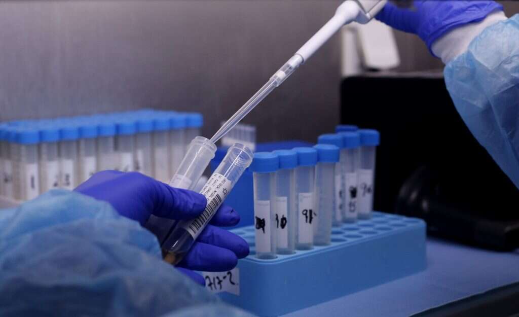 צריך להוסיף כוח אדם. בדיקות קורונה. | AFP צריך להוסיף כוח אדם. בדיקות קורונה. | AFP