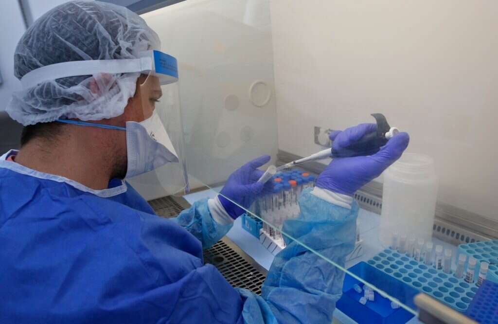 אבחון בדיקת קורונה במעבדת כללית בתל אביב. | AFP אבחון בדיקת קורונה במעבדת כללית בתל אביב. | AFP