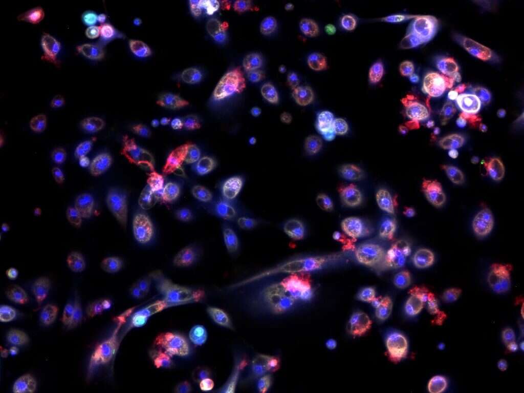 הנגיף דרך עדשת המיקרוסקופ. | קובי נחמיאס