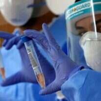 דגימות שנלקחו לגילוי קורונה. | AFP