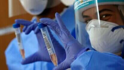 דגימות שנלקחו לגילוי קורונה. | AFP