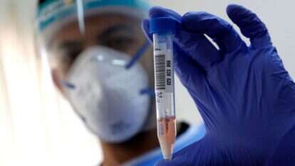 בדיקת קורונה בישראל. | AFP