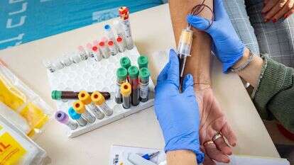 אוליבייה פיטוסי, פלאש 90