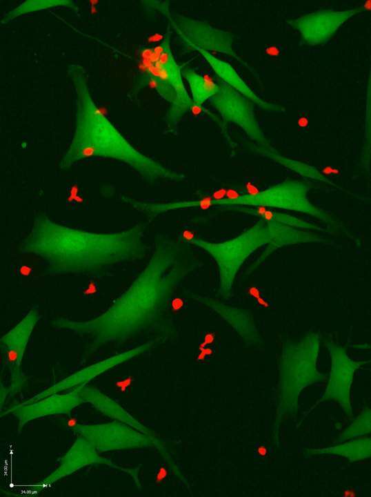 לרתום את מערכת החיסון למלחמה. תאי T( באדום) תוקפים 
תאי סרטן מסוג מלנומה (בירוק). | באדיבות מכון ויצמן למדע