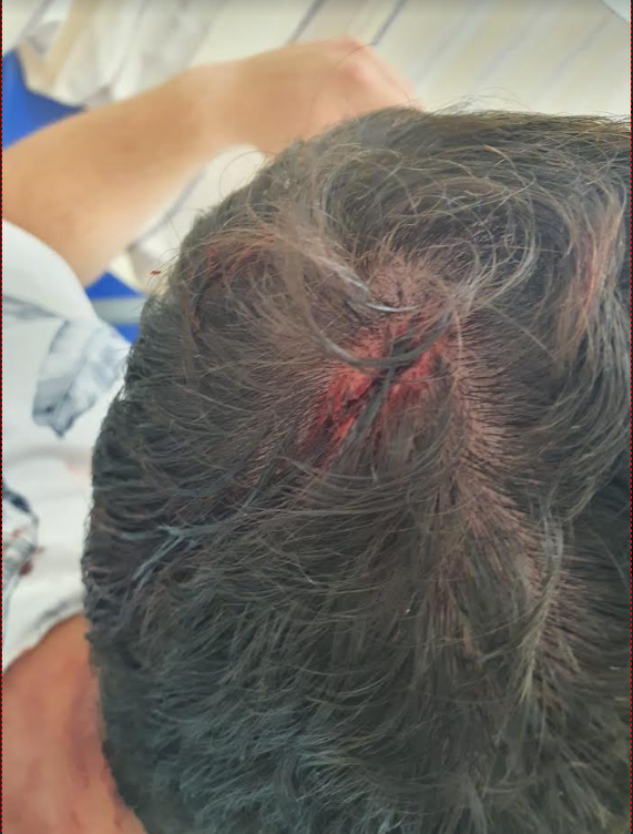 אחד מבני המשפחה בבית החולים. | איילת דיין