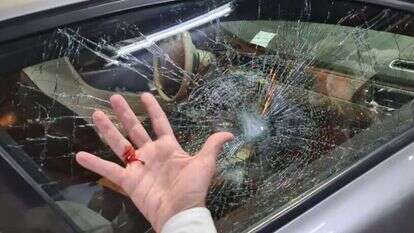 היד הפצועה של הנהג ושמשת החלון המנופצת ברכב של הרב שמואל אליהו