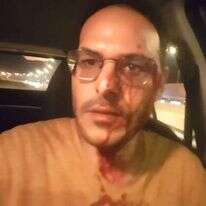 אביחי מרציאנו, שנפצע בלינץ' בכביש 60