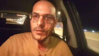 אביחי מרציאנו, שנפצע בלינץ' בכביש 60 אביחי מרציאנו, שנפצע בלינץ' בכביש 60