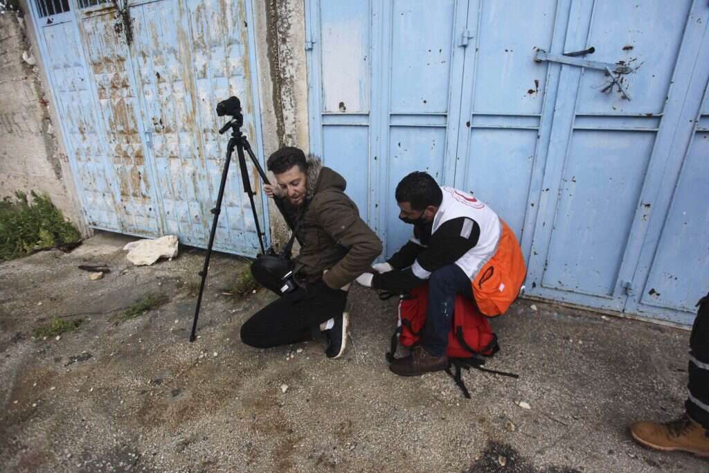תוקפים אלמונים בלבוש אזרחי. עיתונאי בשכםמקבל טיפול רפואי לאחר שנפצע בעת הפגנה. | גטי אימג'ס