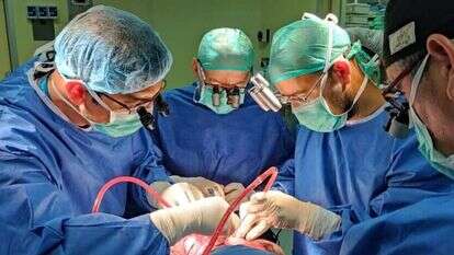 הניתוח להפרדת התאומות הסיאמיות. | דוברות סורוקה