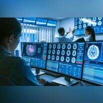 סריקת מוח (אילוסטרציה). | שאטרסטוק