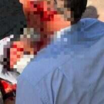 הנהג הפצוע. | ארגון נהגי האוטובוסים, ההסתדרות הלאומית