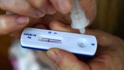 בדיקת קורונה מהירה. | AFP