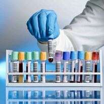 הצלת חיים או בזבוז? בדיקות דם. | שאטרסטוק