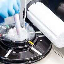 אף פעם לא מאוחר. הקפאת ביציות ועוברים. אילוסטרציה. | שאטרסטוק