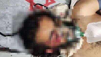 הצעיר שנפצע בדרום הר חברון. | דוברות מד"א