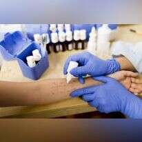 אלרגיה | שאטרסטוק