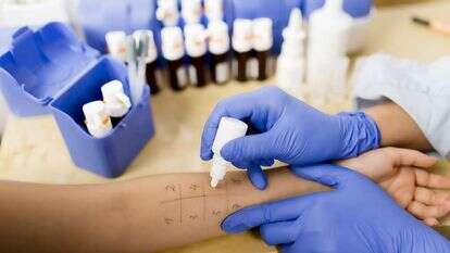 אלרגיה | שאטרסטוק