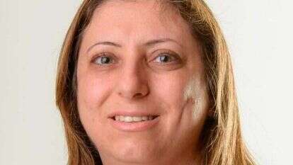 ד"ר חתאם חוסיין. | הקרייה הרפואית רמב"ם