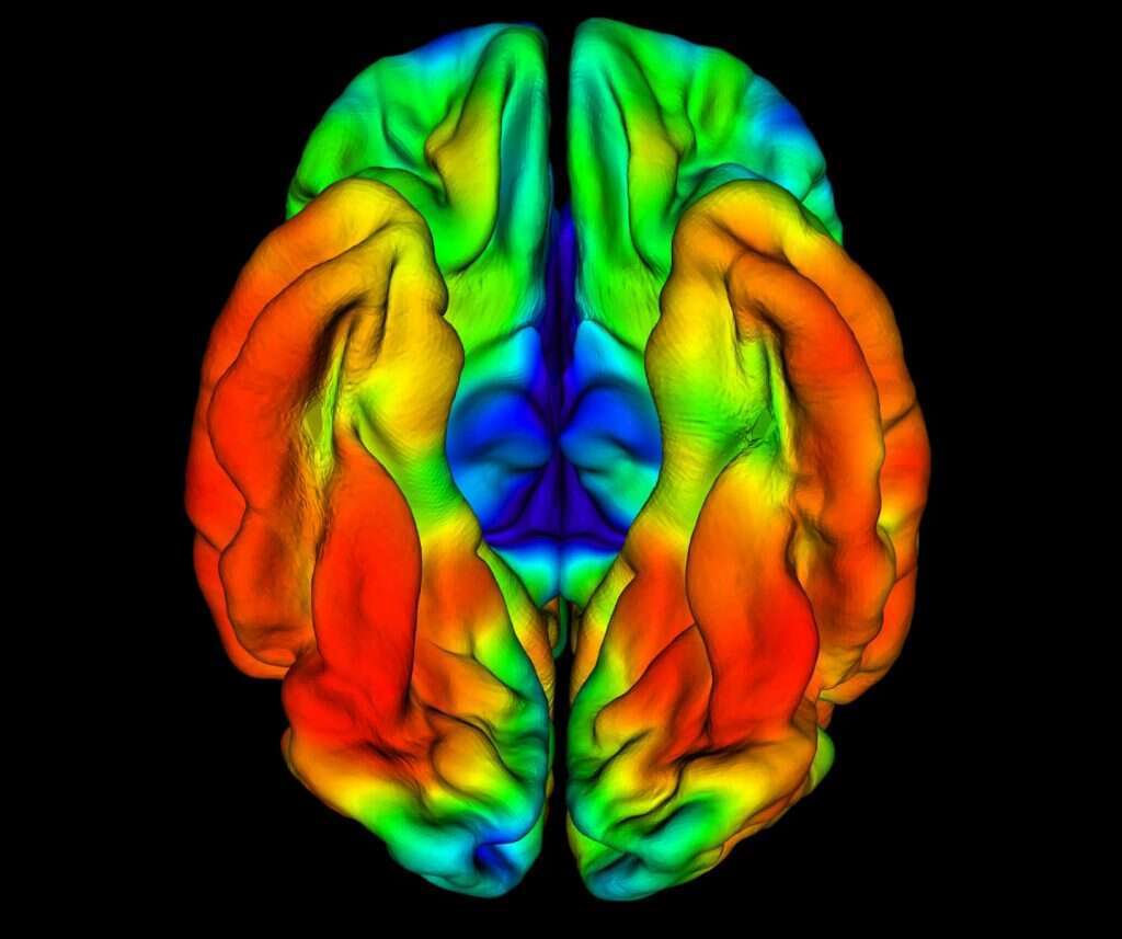 סריקת מוחו של חולה הדמנציה הקולומביאני, שמעידה על הצטברות טאו. | מסצ'וסטס ג'נרל הוספיטל