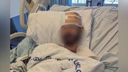 יחיאל אינדור, הפצוע שנפגע בראשו מסלע, בבית החולים יחיאל אינדור, הפצוע שנפגע בראשו מסלע, בבית החולים