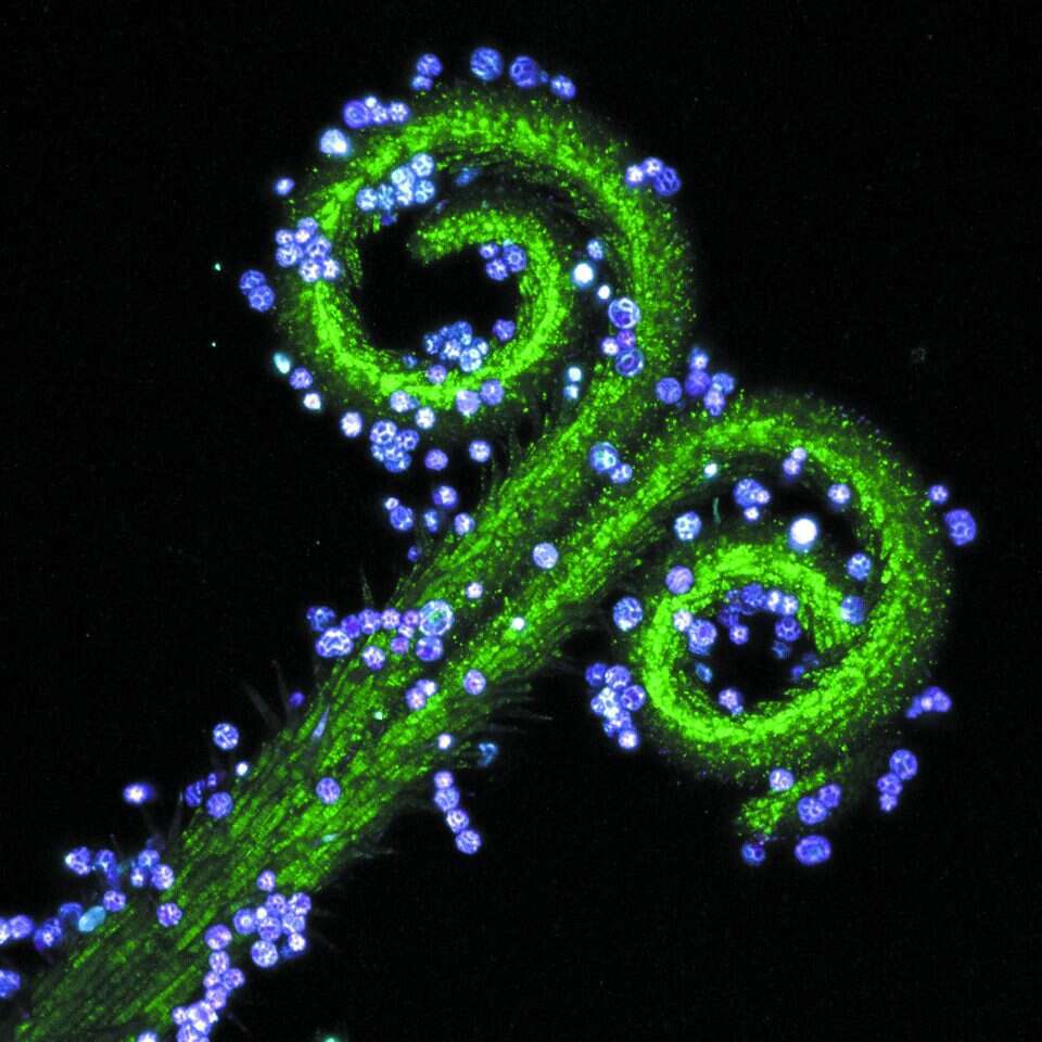 מיקרוסקופיה קונפוקלית מאפשרת להציג שכבות שונות בפרח. איברי הרבייה של לב הארי בתצלום של ליו רומינג