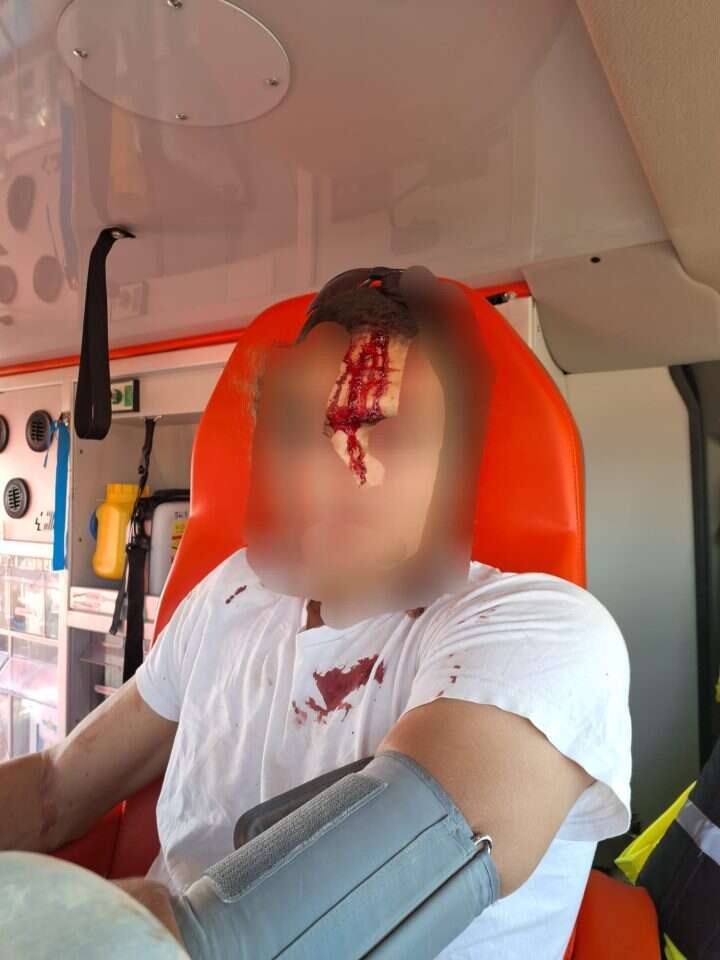 אחד מרועי הצאן שנפגע בלינץ' באזור בנימין. ללא קרדיט