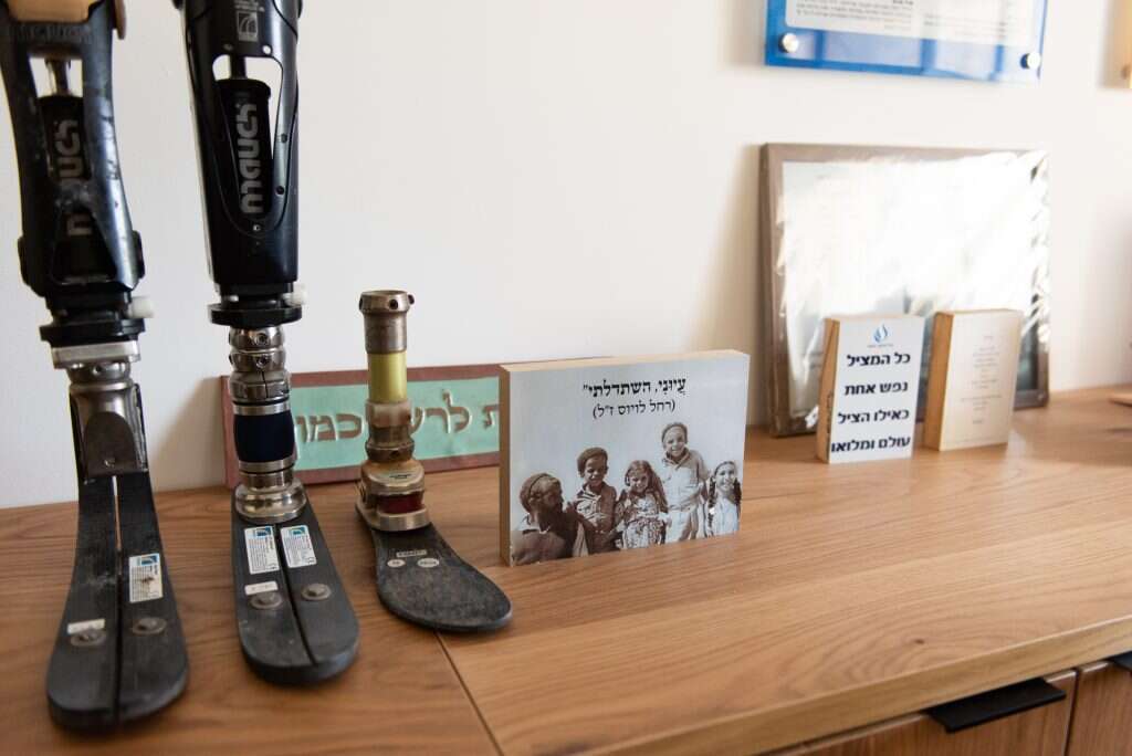 את מידת הנכות אתה זה שקובע. הפרוטזות של לויוס במשרדו. | אביטל הירש