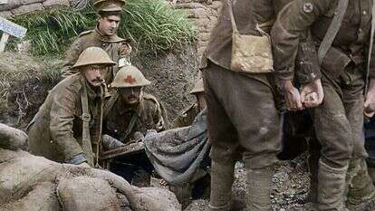 אחיו של החייל הפצוע מתעד את מציאות המלחמה שסביבו ומשתגע. פינוי פצוע בחזית במלחמת העולם הראשונה מתוך הסרט התיעודי "הם לא יזקינו". באדיבות יס דוקו