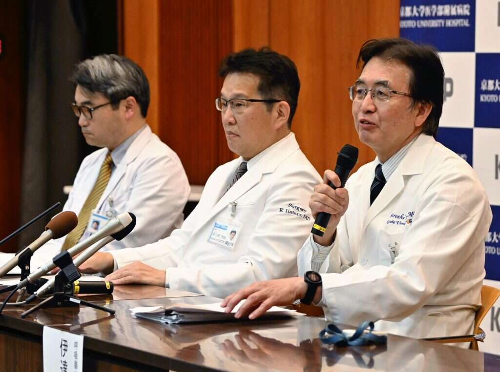 פרופ' הירושי דייט, מימין, מדבר על השתלת הריאה-כבד המשולבת הראשונה בעולם של תורם חי במסיבת עיתונאים בבית החולים האוניברסיטאי של קיוטו. | The Japan News