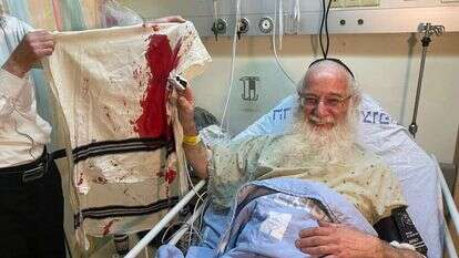 הפצוע מהפיגוע בנווה יעקב, הרב צבי טל. | דוברות הדסה