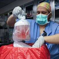 כליית החזיר לפני שהושתלה במטופל. | Massachusetts General Hospital via AP