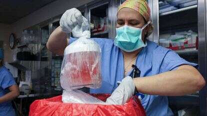 כליית החזיר לפני שהושתלה במטופל. | Massachusetts General Hospital via AP כליית החזיר לפני שהושתלה במטופל. | Massachusetts General Hospital via AP