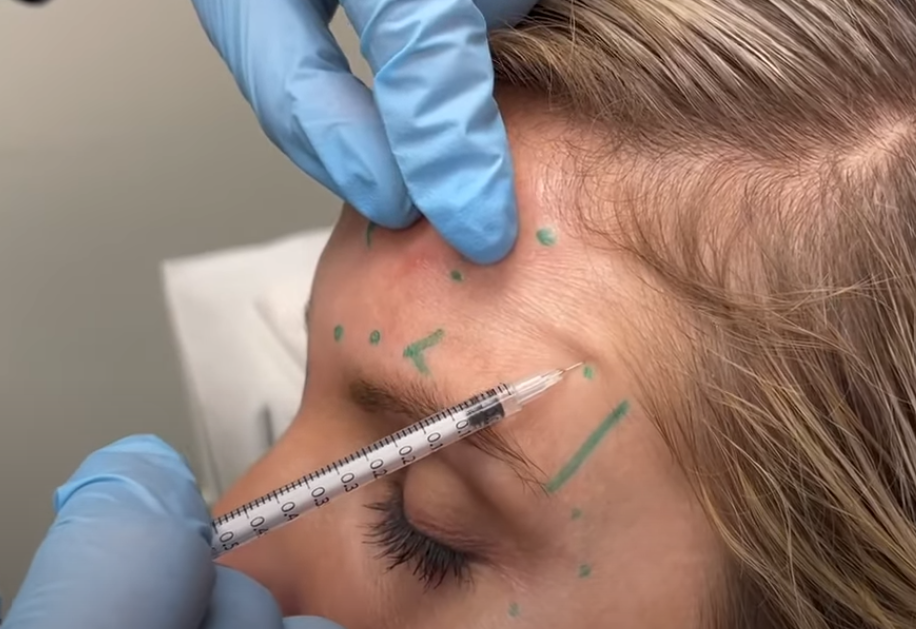 זריקת בוטוקס. | מסך מיוטיוב